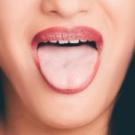 What Are The Facial Signs Of B12 Deficiency